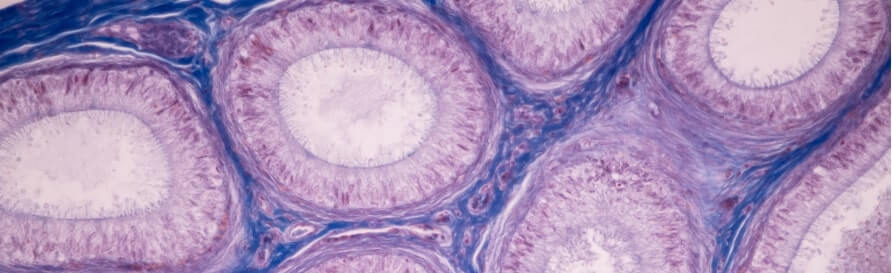 Anatomy and histological ovary