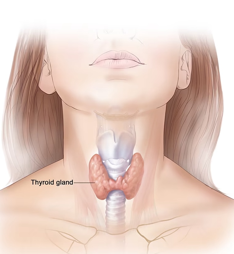 hyperthyroidism cause infertility