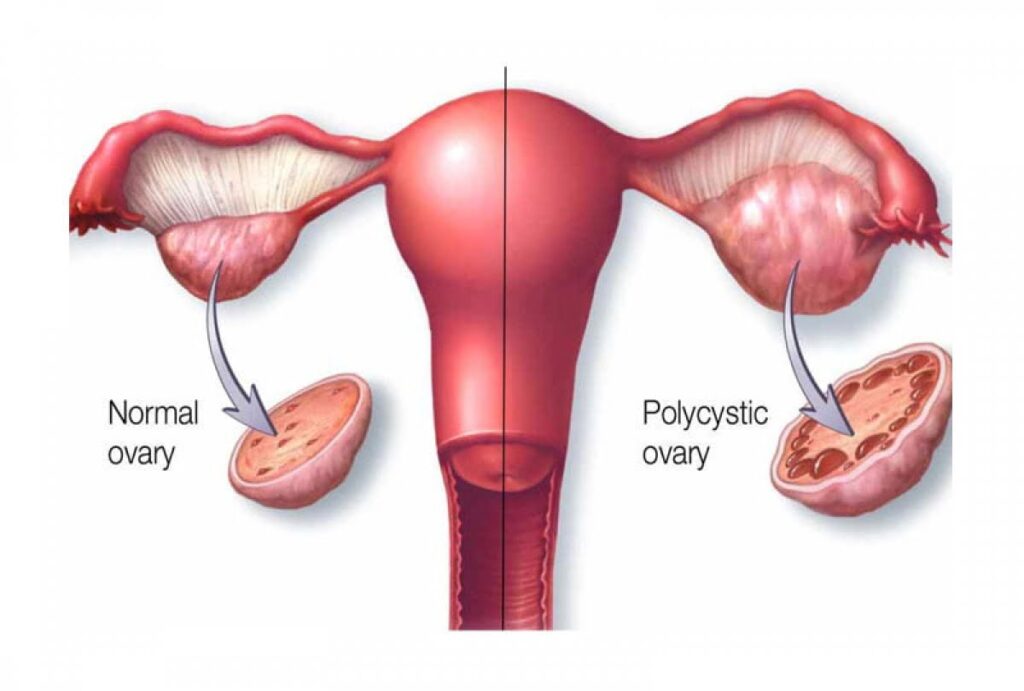 The Importance of Consulting a Fertility Specialist When Trying to Conceive