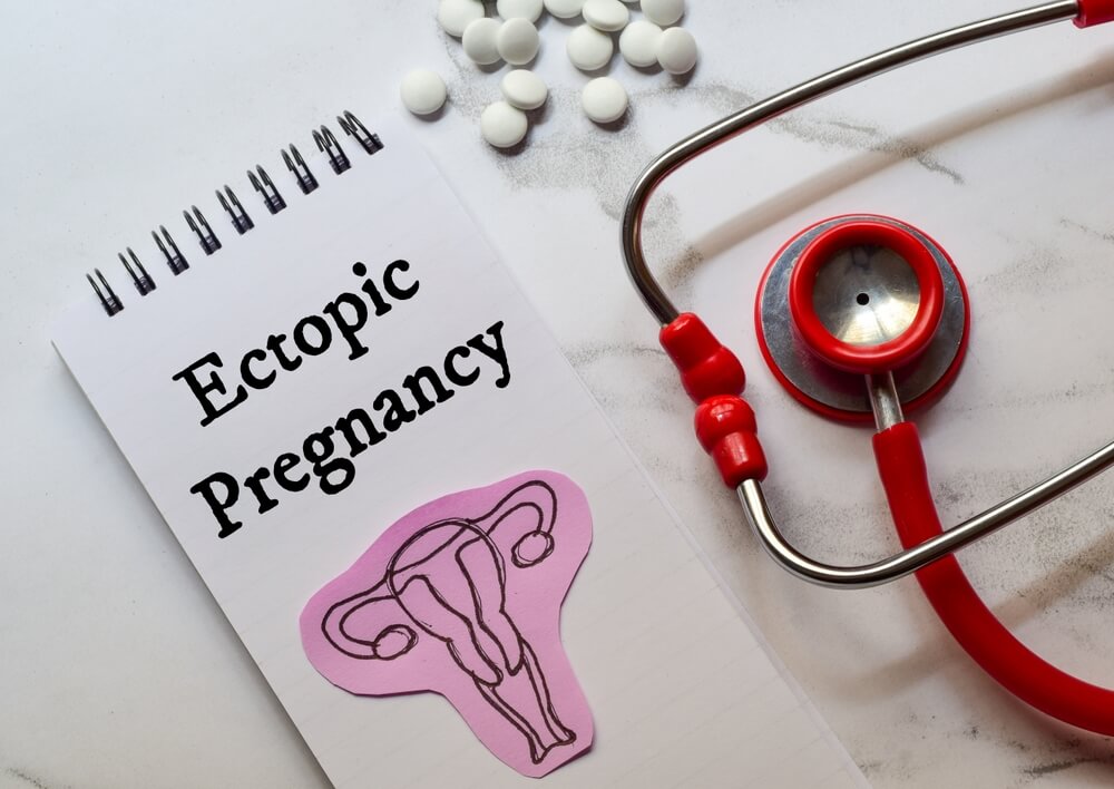 ectopic pregnancy